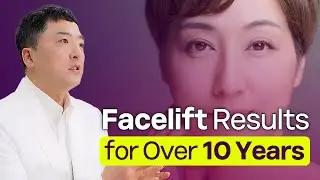 How to Maintain Facelift Results for 10 Years! Revealing the Secrets to Long-Lasting Lifting Effects