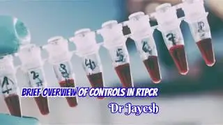 Brief Overview of Controls In PCR