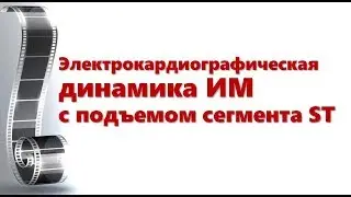 ЭКГ-динамика ИМпST
