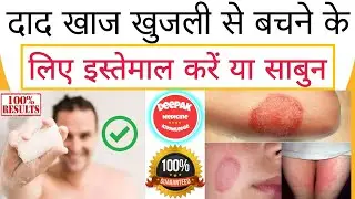Nuforce Sabun दाद खाज खुजली से दिलाया छुटकारा ,नुफोर्स साबुन।