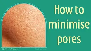 Minimise large pores and combat oily skin!
