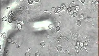 ПКТ отрицательный 7