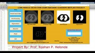 Lung Nodule Detection On Dicom Image Using Machine Learning | With Source Code | Python Project Code