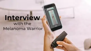 Melanoma Warrior story: Maria