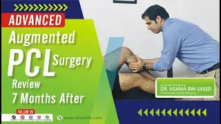 🌟 Advanced Augmented PCL Reconstruction Surgery: 7-Month Review 🌟