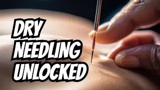 Dry Needling of The Shoulder- Unlock the Power of the Needle