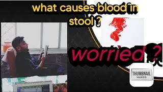 colorectal polyp in children's,symptoms,diagnosis and treatment|surgeon Dr waqar khattak