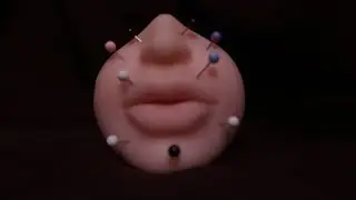 ASMR: ACUPUNTURA