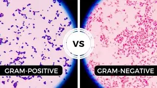 Gram +ve vs Gram -ve Bacteria