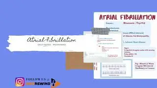 Atrial fibrillation - Dailynotes