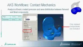 Abaqus Knee Simulator-Accelerating the Design of Knee Implants