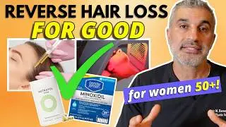 Hair Loss for Women over 50, what ACTUALLY works??