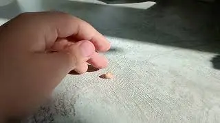 у меня выпал зуб ШОК!
