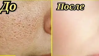 Юз учун гуручли маска тайёрлаймиз. ёшартиради.оажинларни кетгизади