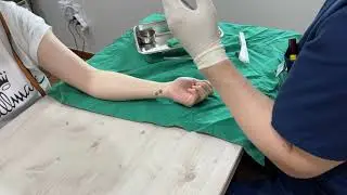 임플라논 삽입 과정 (Implanon insertion process)