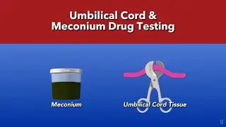 Understanding Advanced Newborn Drug Testing