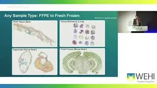 Feterl M: Mapping the Universe of Biology with the GeoMx DSP
