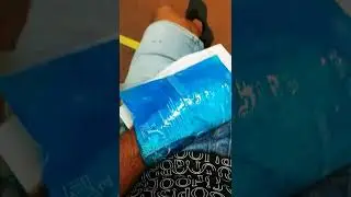 Попал в госпиталь на КОРФУ