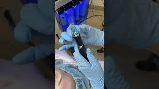 Вакуумный гидропилинг Хайдрафешл! #cosmetology #shorts #short