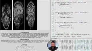 Debugging 3D Brain MRI Viewer: Solving Volumetric Data Rendering Issues in JavaScript and Flask