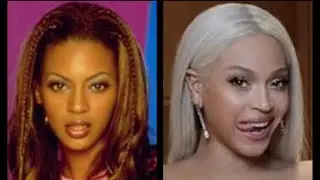 Beyoncé Bleaching keep it Real 💯💯💯