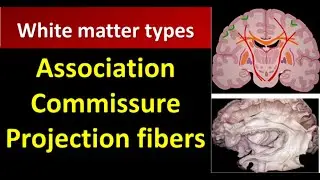 White Matter CNS : Association Commissure  Projection fibers