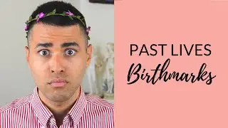 Past Lives Birthmarks and How to Recognize Them