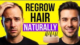 Best Home Remedies To Grow Hair On a Balding Head
