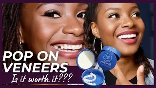 Pop On Veneers Experience