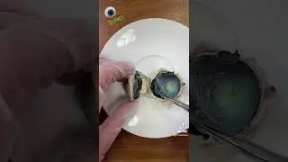TikTok Eye Dissection - follow me on TikTok for more quick biology videos