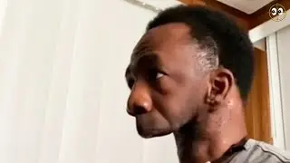 Remember the American MAN with no JAW? He FOUND his LOVE and is HAPPY!