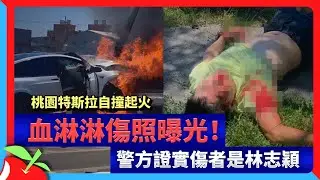 桃園特斯拉自撞起火　血淋淋傷照曝光！警方證實傷者是林志穎 | 台灣新聞 Taiwan 蘋果新聞網