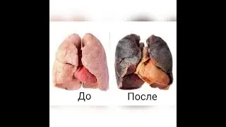 О вреде курения  #бросить курить #курение вредит здоровью#вред курения #курение убивает #