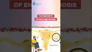 Top 10 Secrets of Endometriosis | Dr Supriya Puranik 