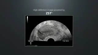Mindray Resona I9