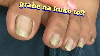 part2 halimaw na kuko.Di naka ranas mag linis ng kuko