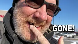 HOW I WRECKED MY TEETH!