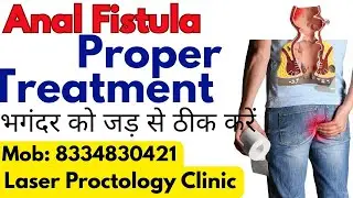 Fistula ka best treatment kya hai