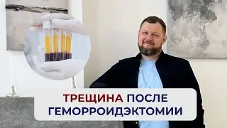 Что делать если появилась трещина после операции на геморрой?