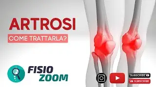 Artrosi/ #FisioMap