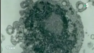 Epidémie : retour sur le Sras qui avait affolé le monde en 2003 - Reportage 