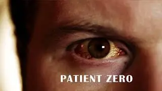 VFX Test - Eye Effects