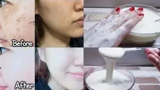 اقسم بالله اقوى وصفة لتبييض تخلي وجهك وجسمك كيف لمرايا❤