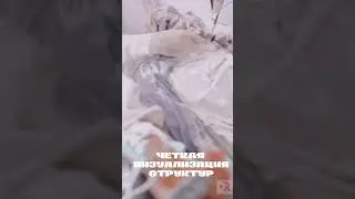 Лапароскопическая герниопластика в БЦГБ