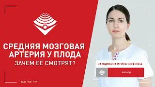 Средняя мозговая артерия у плода. Зачем её смотрят?