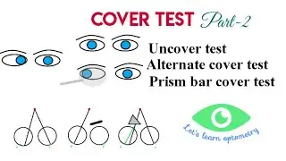 Cover test part-2 | uncover test| Alternate cover test | Prism bar cover test