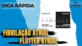 Fibrilação Atrial Versus Flutter Atrial