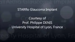 STARflo implantation surgery - Prof. Philippe Denis
