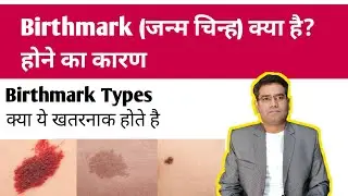 Birthmark Causes and Types | Is it Dangerous? How to Remove birthmark..