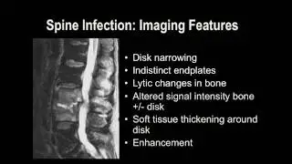 Understanding Basic MRI of the Spine
